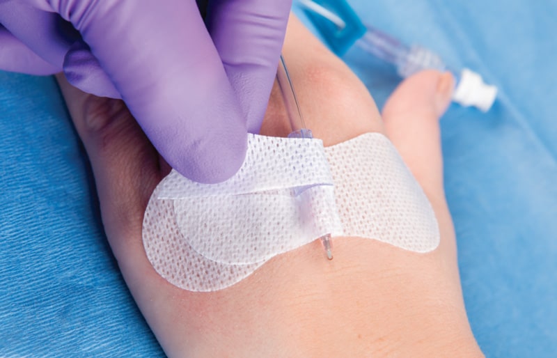 GripLok Securement Devices from TIDI MED Alliance Group, Inc.