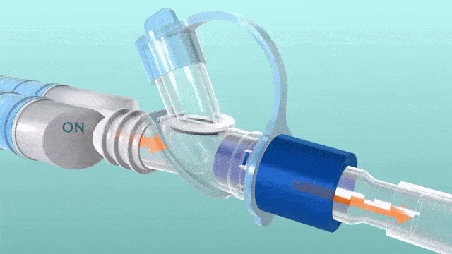 Flusso By Pass Connections gif large Flusso By Pass Adapter GIF