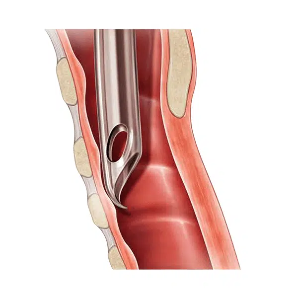 Flex-Tip® Endotracheal Tubes by Salter Labs