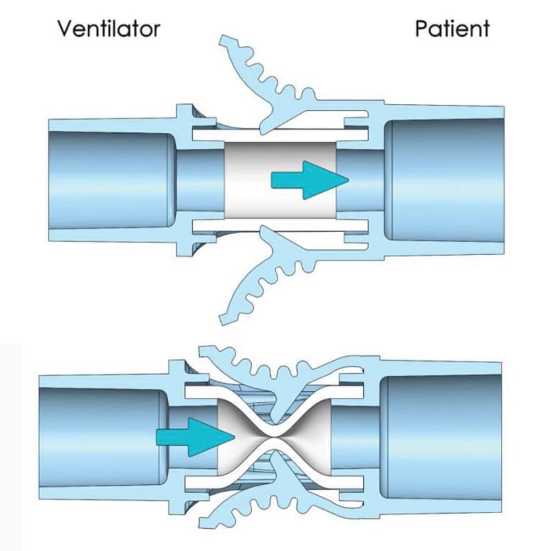 Flusso TFI by Solutions in Critical Care