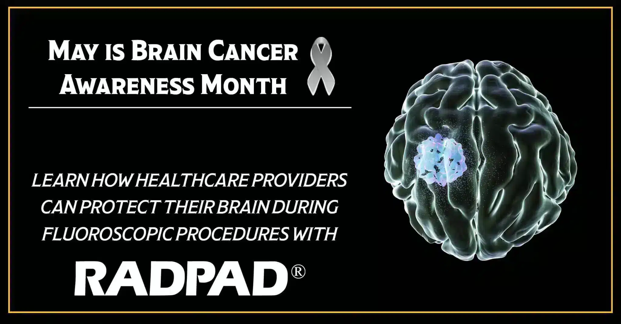 Learn how healthcare providers can protect their brain during fluoroscopic procedures with Radpad