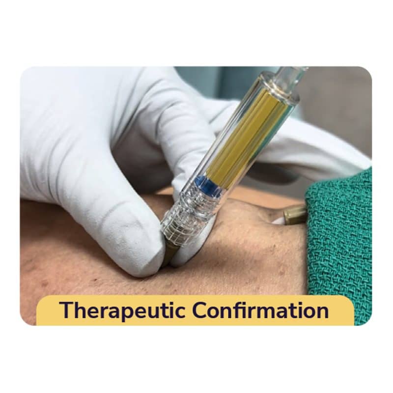 Pneumeric Capnospot Therapeutic Confirmation