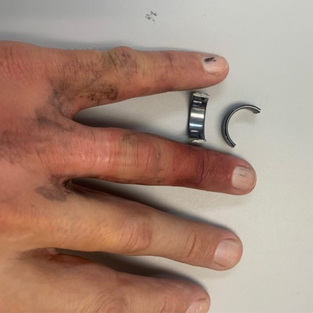 Ring Cut Off Finger with Dolphin Ring Cutter