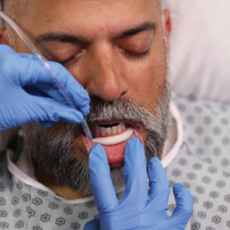 SWIK® Oral Secretion Management Device by SWIK Medical