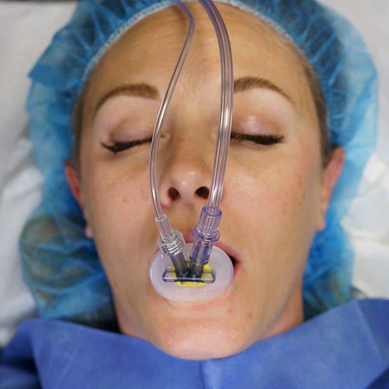 Aeris Airway Device from Airway Innovations