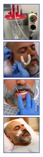 pump swik inserting patient 300x1100 SWIK Automated Hands Free Oral Secretion management