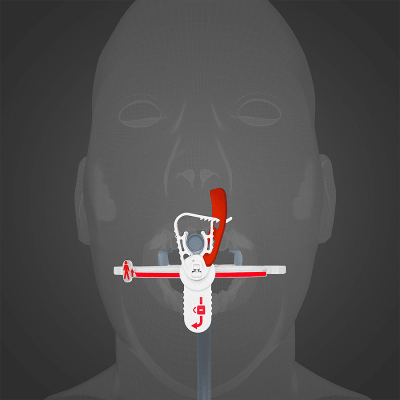 The Horseshoe from Surgicure Technologies