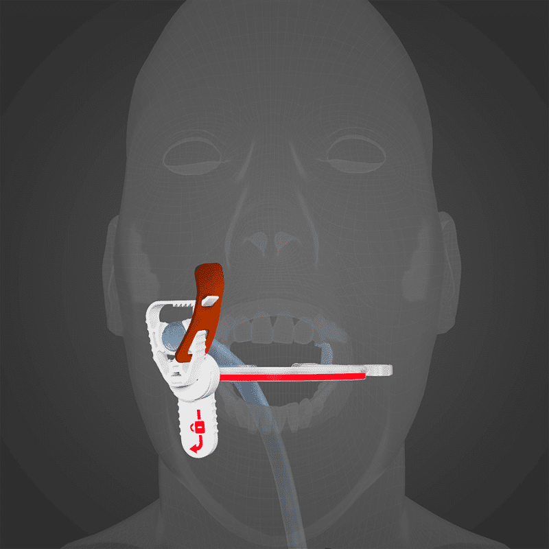 The Horseshoe from Surgicure Technologies