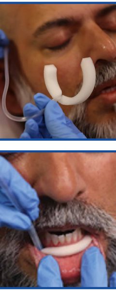 SWIK Oral Secretion Management