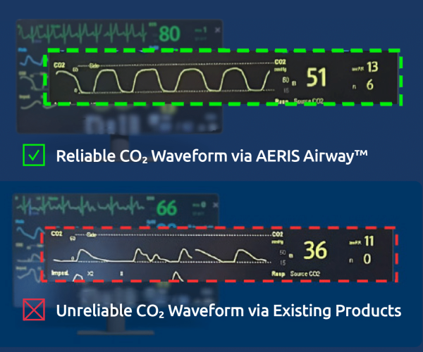 AERIS CO2 Waveform