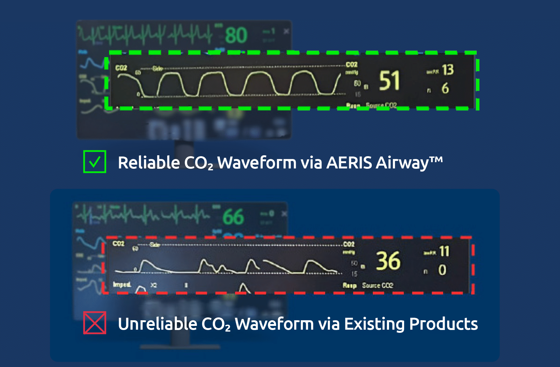 AERIS-CO2-Waveform AERIS CO2 Waveform