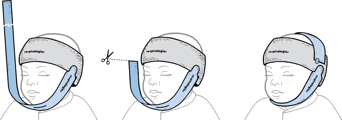 Baby-Band-for-Chin-and-Head-How-to-Customize Respiralogics Baby Band for Chin and Head