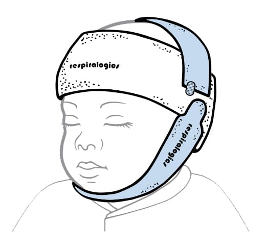 Baby-Band-for-Chin-and-Head Respiralogics Baby Band Chin and Head