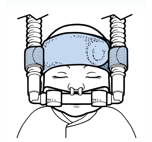 Baby-Head-Band-and-Circuit-Bumpers Respiralogics Baby Head Band and Circuit Bumpers