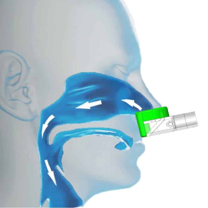 xchange NIV CPAP by Pneuma Therapeutics